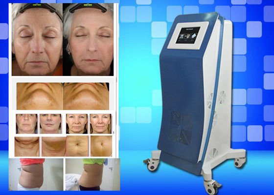 Het Materiaalgewicht van Lipo van de Cryo verliest het Bevriezende Laser de Machine van de Huisschoonheid